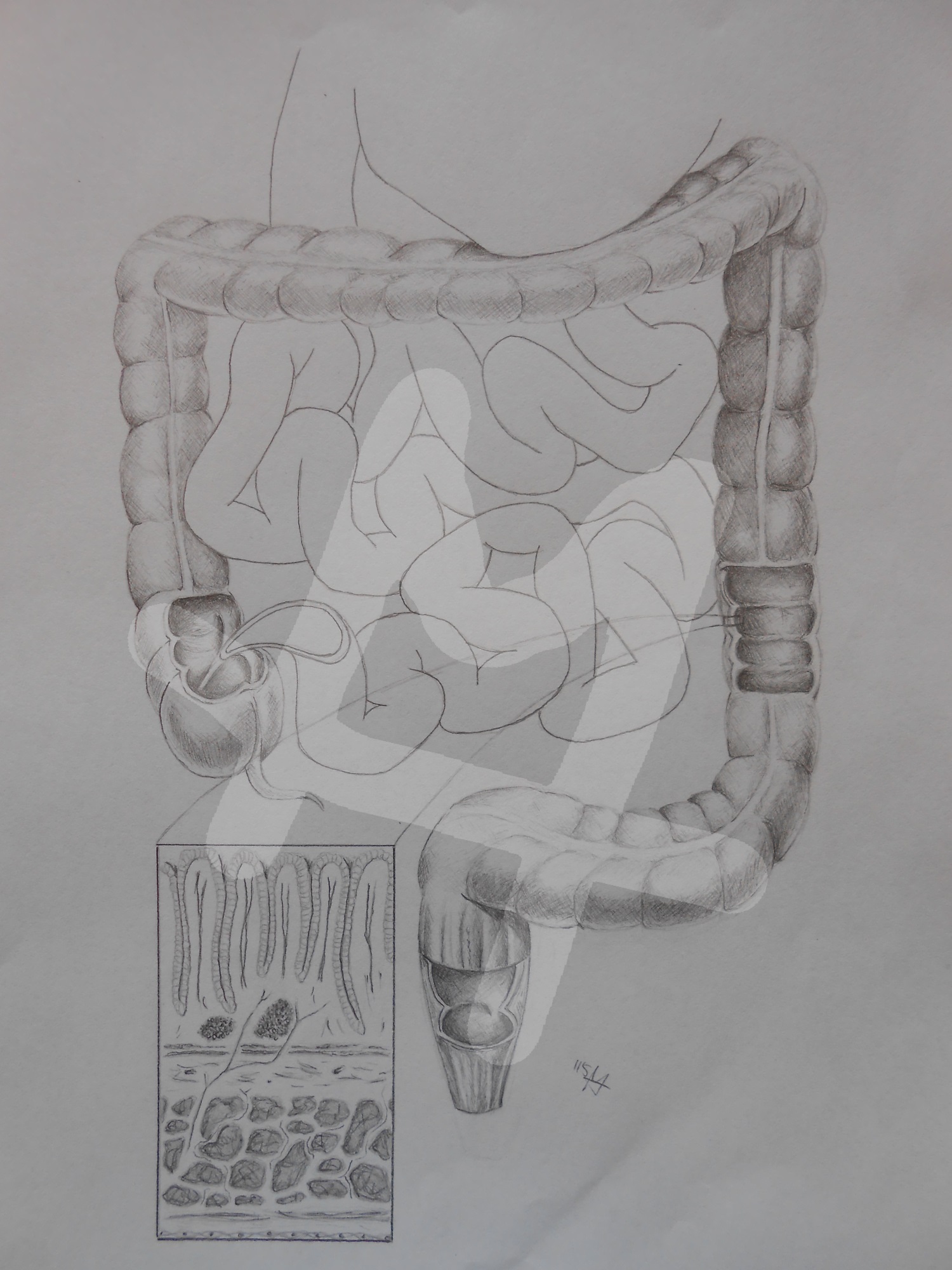 Colon