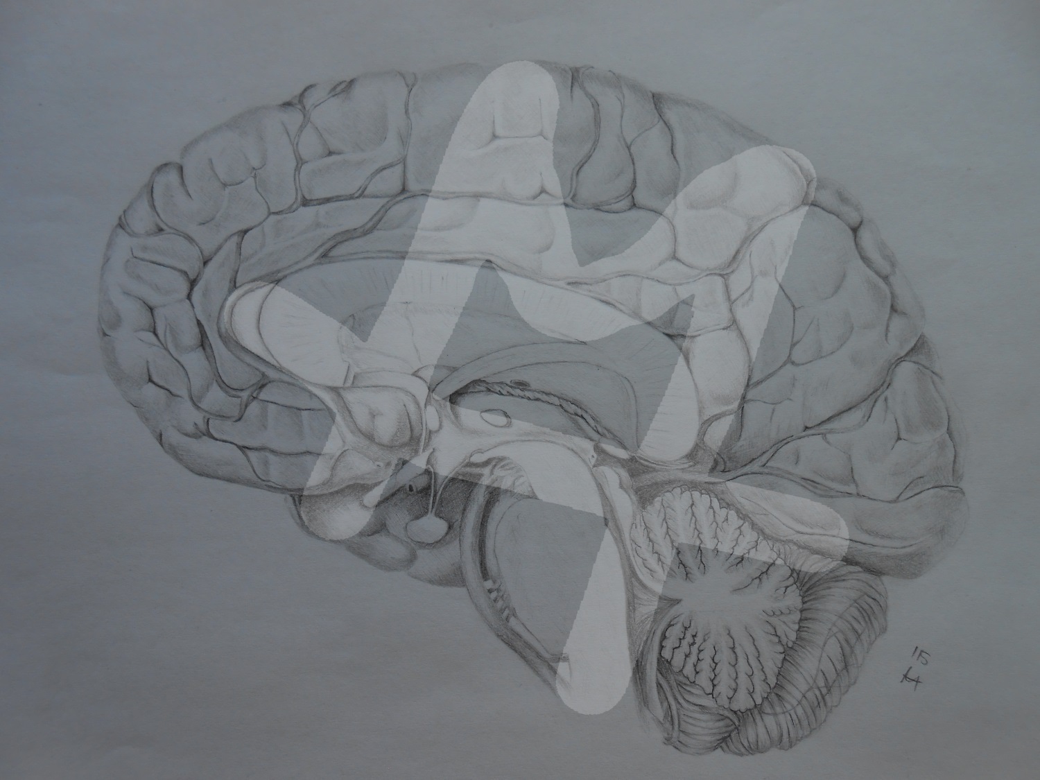 Gehirn (Querschnitt)